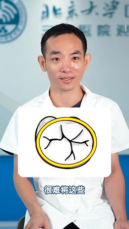 窝沟封闭有必要做吗?