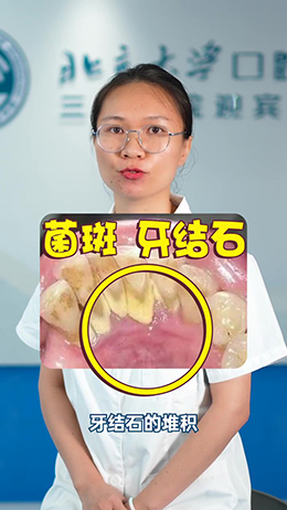 一刷牙就出血?别慌,看看医生怎么说